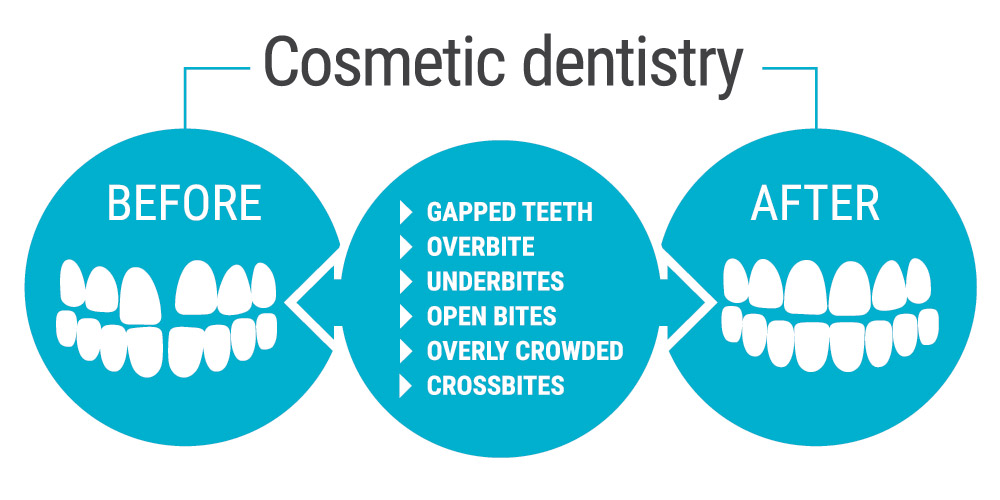 Before & After Cosmetic Dentistry in Provo, UT