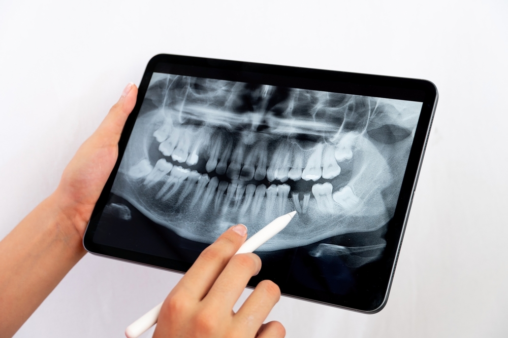 dentist provo Jeppson Dental team providing friendly and professional dental care in a modern, comfortable environment in Provo, UT.