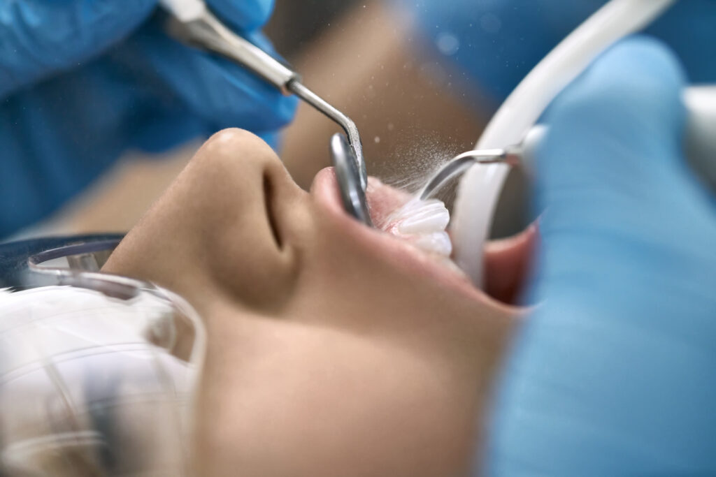 Dental Cleanings & Exams provo